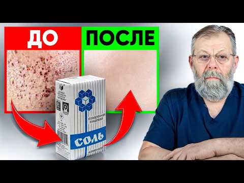 Видео: СОЛЬ И ВОДА — СЕКРЕТ УПРУГОЙ КОЖИ И ЗДОРОВОЙ ЖЕЛЧИ