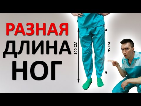 Видео: Ноги разной длины. В каком случае бежать к доктору? Причины возникновения и методы лечения