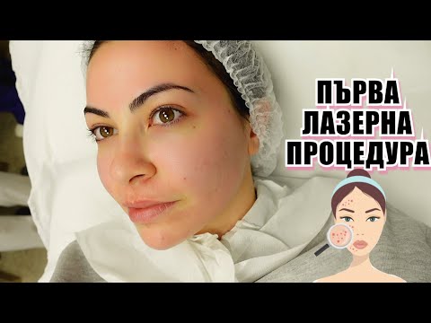 Видео: ЛАЗЕР ЗА БЕЛЕЗИ ОТ АКНЕ + как излекувах проблемна кожа 💕