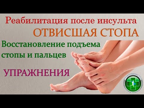 Видео: Отвисшая стопа. Восстановление подъема стопы. Упражнения.