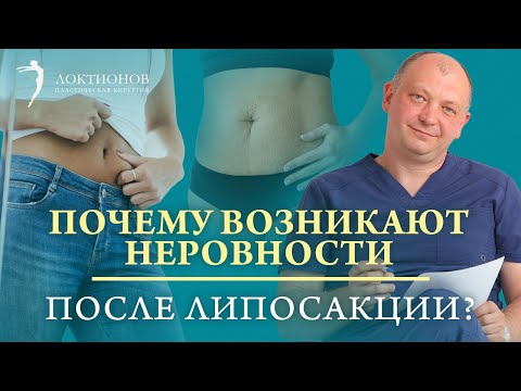 Видео: Неровности и бугры после липосакции. Почему они появляются и как от них избавиться