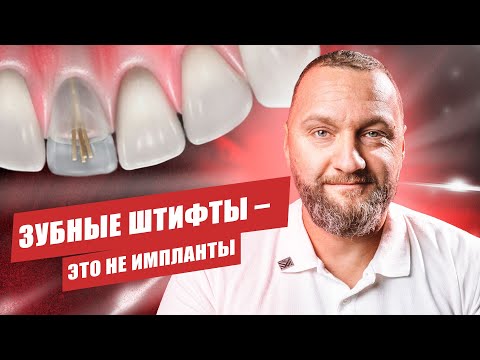 Видео: 🇺🇦 Почему "зубной штифт" — это не имплант