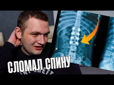 Видео: КАК Я СЛОМАЛ СПИНУ