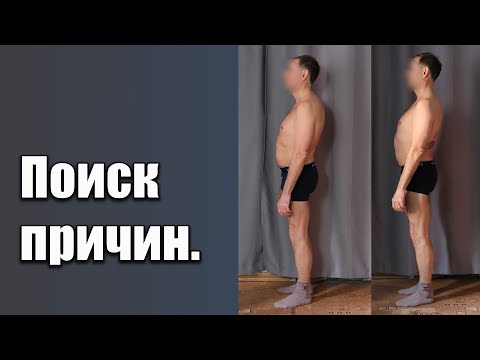 Видео: Исправление осанки. Разбор и поиск причин.