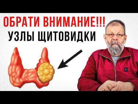 Видео: Узелки в щитовидной железе. Объяснение доктора медицинских наук.
