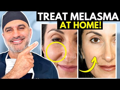 Видео: Что вам НУЖНО знать о ПРАВИЛЬНОМ лечении мелазмы ДОМА!