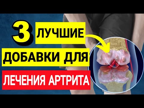 Видео: ТОП-3 ПОЛЕЗНЫХ ДОБАВОК ПРИ АРТРИТЕ, КОТОРЫЕ РЕАЛЬНО ПОМОГАЮТ.