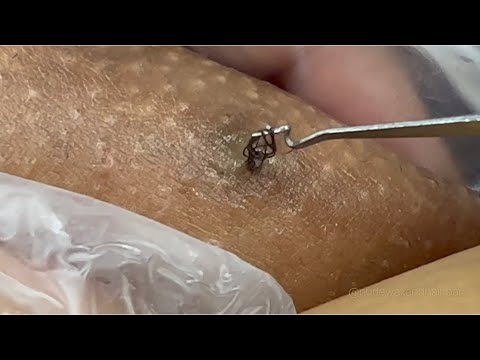 Видео: Я вернулся! С новыми извлечениями! Эпизод 17!