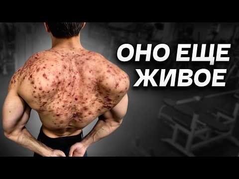 Видео: Гной Лезет Из Ушей / Последствия Химии