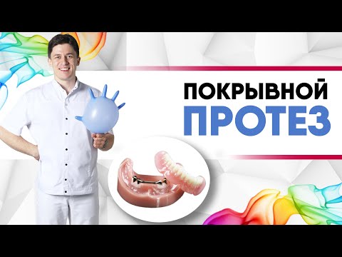 Видео: Покрывной протез [ съёмный зубной протез, который перекрывает зубы или имплантанты ]. Балка/локатор.