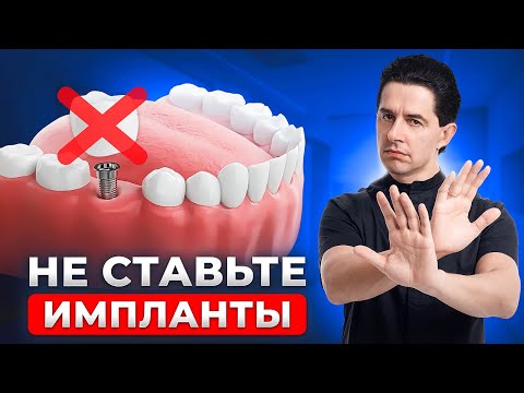 Видео: Кому нельзя ставить импланты? Стоматологи молчат об этом