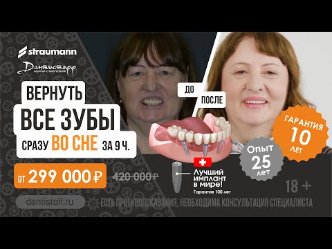 Видео: Имплантация зубов во сне до/после😍. Инфаркт не приговор! +7 495 2555937 Straumann ProArch