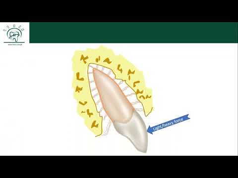 Видео: Биологическая реакция зуба на легкую ортодонтическую силу