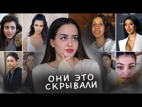 Видео: Почему у тебя никогда не будет "идеальной" кожи? | Нереалистичные стандарты красоты