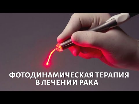 Видео: Фотодинамическая терапия в лечении рака. Доктор Каприн