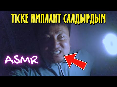 Видео: Тіске имплант салдырдым / Брекетті жақында шешемін / Қазақша АСМР / Түнді әңгіме / Сыбырлау / ASMR