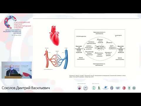 Видео: Время начала ЭКГК Соколов Д.В.