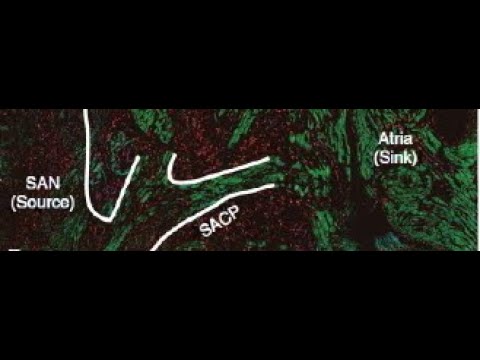 Видео: Синдромы J волны