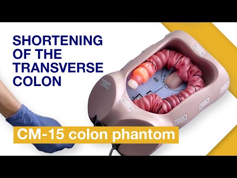 Видео: Основные техники введения колоноскопа | Упражнение 4: Укорочение поперечной ободочной кишки