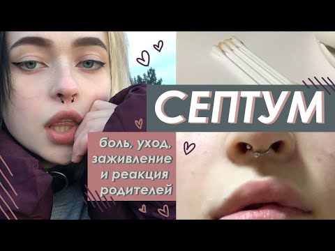 Видео: история одного септума