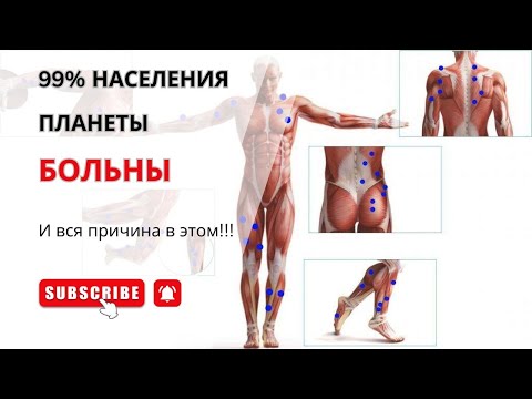 Видео: ВСЯ ПРАВДА про МИОФАСЦИАЛЬНЫЙ релиз (МФР) и "ТРИГГЕРНЫЕ ТОЧКИ"