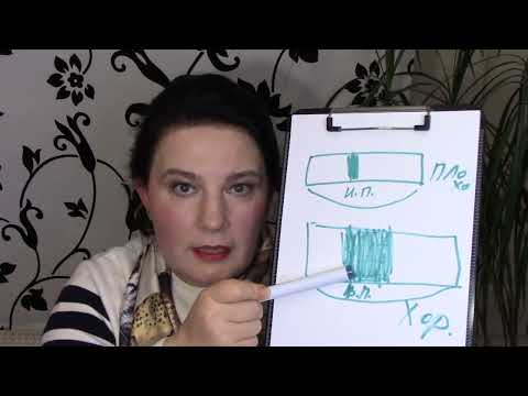 Видео: Повышенный холестерин. Что делать?