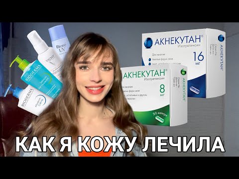 Видео: АКНЕКУТАН. МОЯ ИСТОРИЯ ЛЕЧЕНИЯ, средства, побочки и  результаты.