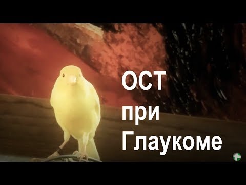 Видео: Оптическая когерентная томография (ОКТ, ОСТ) при глаукоме.