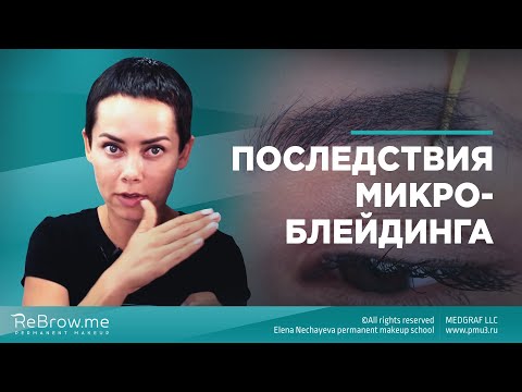 Видео: Последствия микроблейдинга #микроблейдинг
