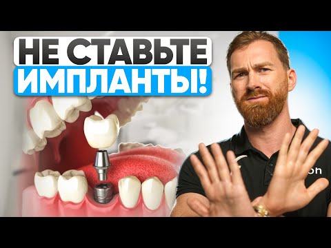 Видео: Вам НЕЛЬЗЯ ставить импланты! Стоматологи молчат об этом!