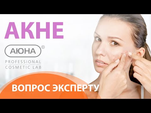 Видео: АКНЕ: вопрос ЭКСПЕРТУ