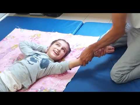 Видео: Спастический тетрапарез ДЦП cerebral palsy