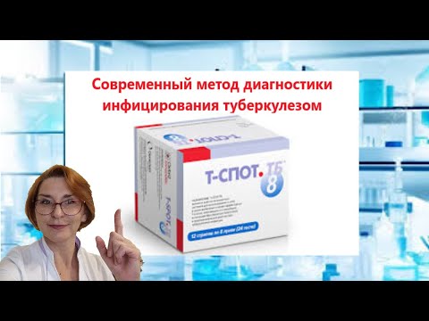 Видео: Т СПОТ