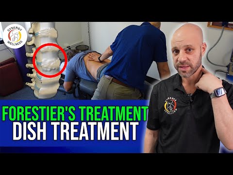 Видео: DISH, диффузный идиопатический гиперстоз скелета, анкилозирующий спондилит, лечение по методу Фор...