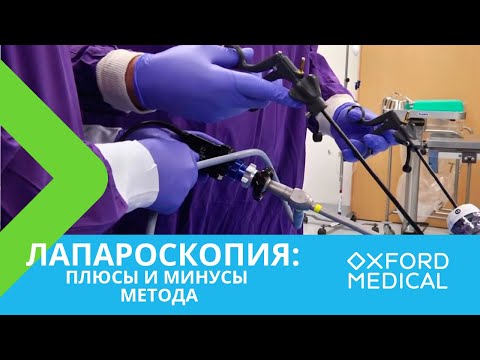 Видео: Лапароскопия: плюсы и минусы метода