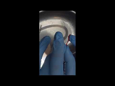 Видео: Моделирование штифтово-культевой вкладки прямым способом
