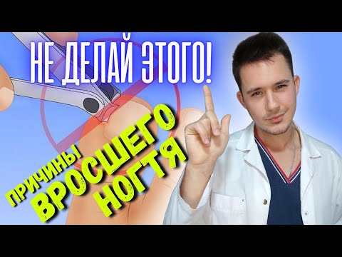 Видео: Ногти. Вросший ноготь. Причины. Педикюр, маникюр или?...
