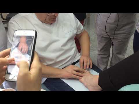 Видео: #изготовление #курсыпедикюра #подология  индивидуального ортеза силиконом Фреско .