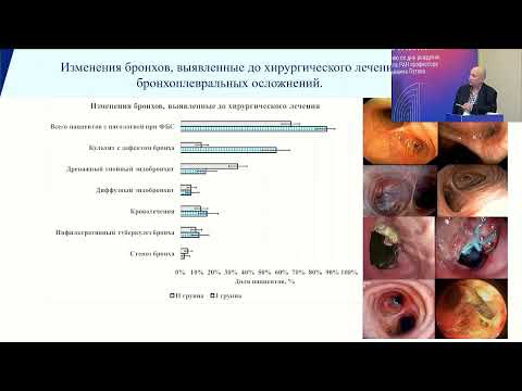 Видео: Хирургическое лечение бронхоплевральных осложнений после резекций легких и пневмонэктомий