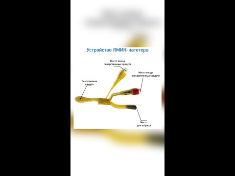 Видео: Лечение синусита(гайморита) без «проколов»👍🏼