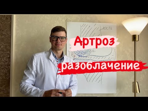 Видео: Детальный разбор причин развития артроза/ гонартроз/ коксартроз/ артрит/ остеоартроз разрушаем мифы