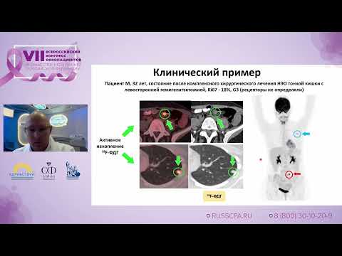 Видео: Долбов А.Л. | ПЭТ/КТ диагностика НЭО: маршрут от подготовки к исследованию до заключения