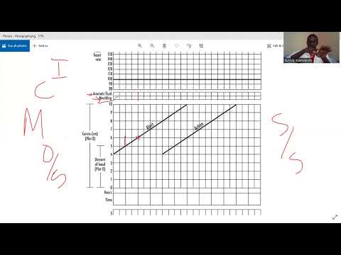 Видео: партограмма ОБСЕ