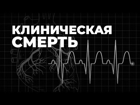 Видео: Клиническая смерть