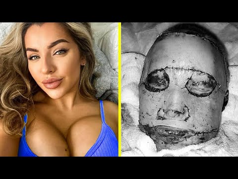 Видео: Когда СТРЕМЛЕНИЕ к красоте ЗАШЛО СЛИШКОМ ДАЛЕКО