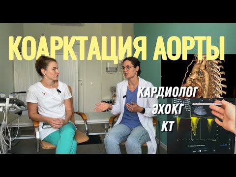 Видео: Коарктация аорты в 30+. Роды с коарктацией аорты. Кардиолог. ЭхоКГ -как не пропустить коарктацию. КТ