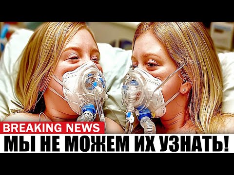 Видео: 3 минуты назад: Сиамских близнецов разъединили – правда ли слухи?