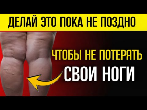 Видео: Делай это СЕГОДНЯ, иначе будешь ХРОМАТЬ на СТАРОСТИ ЛЕТ