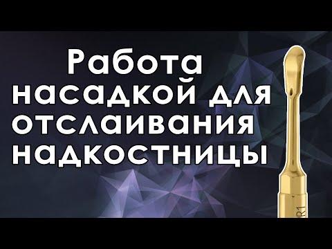 Видео: Субпериостальное препарирование