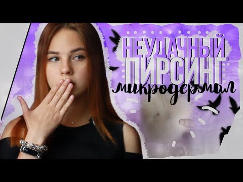 Видео: 😱МОЙ НЕУДАЧНЫЙ ПИРСИНГ│МИКРОДЕРМАЛ😱